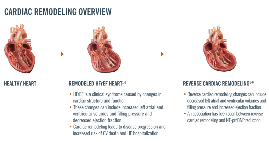 cardiac remodeling overview
