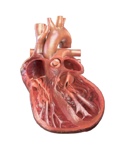 Cardiac remodeling HFrEF heart