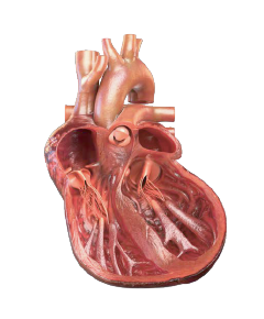 Cardiac remodeling HFrEF heart
