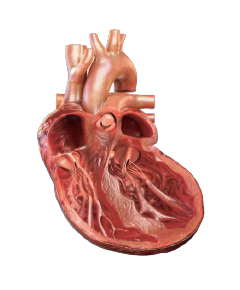 Cardiac remodeling heart