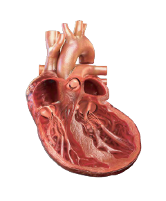 Cardiac remodeling heart